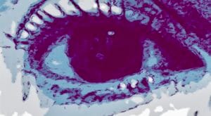 373º fragmento- La opción real es menos mala